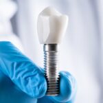 Important Factors To Consider Just Before You Have Dental Care Implants Abroad Found In 2023