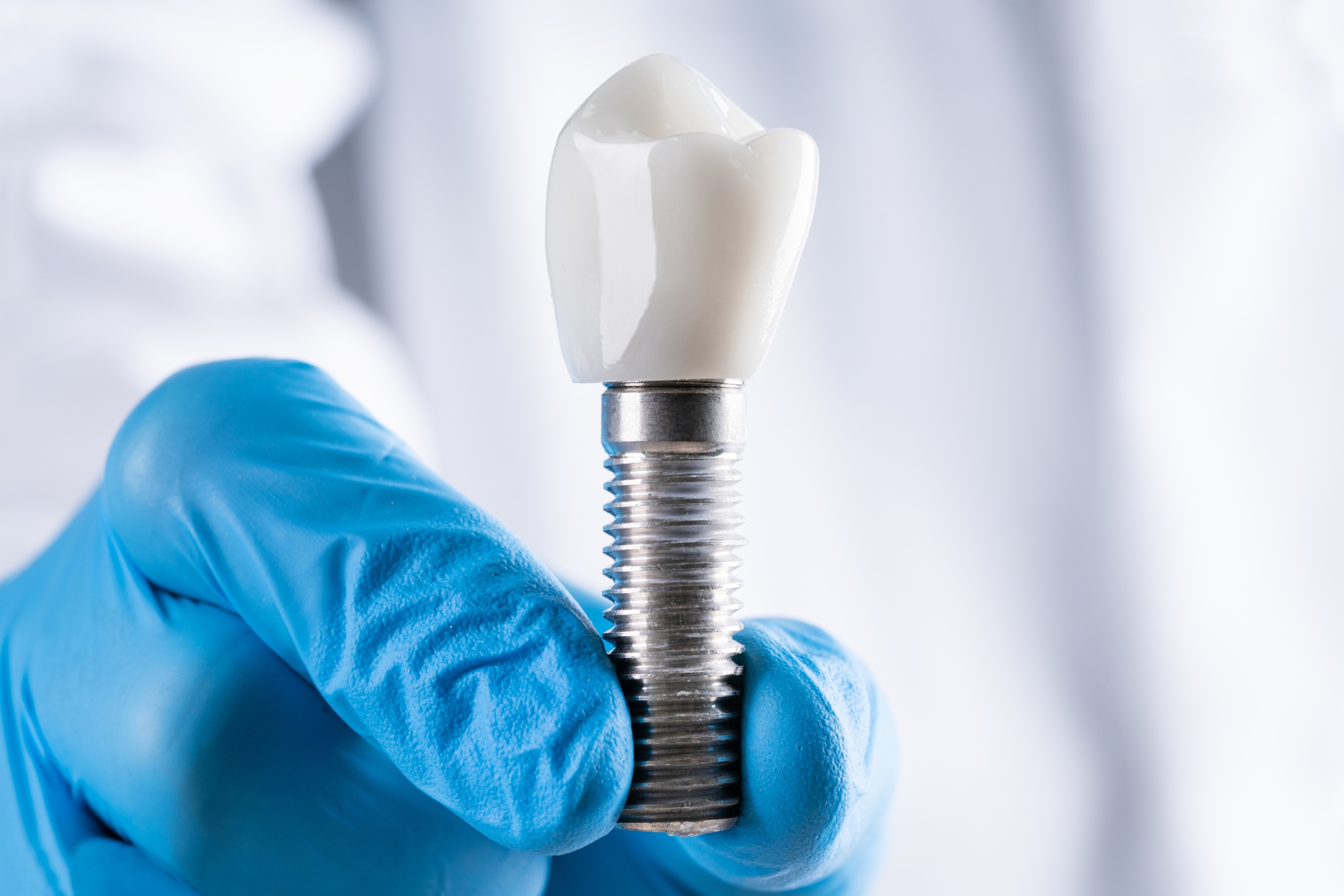 Important Factors To Consider Just Before You Have Dental Care Implants Abroad Found In 2023