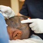 Hair Transplant Prices and Service in Turkey